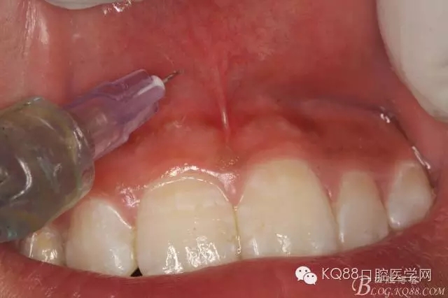 640.webp (2).jpg 640.webp (2).jpg