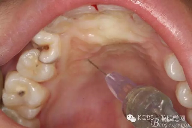 640.webp (3).jpg 640.webp (3).jpg