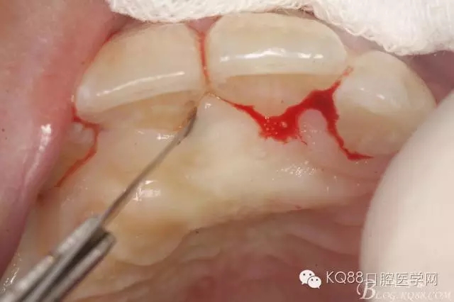 640.webp (4).jpg 640.webp (4).jpg