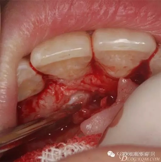 640.webp (6).jpg 640.webp (6).jpg