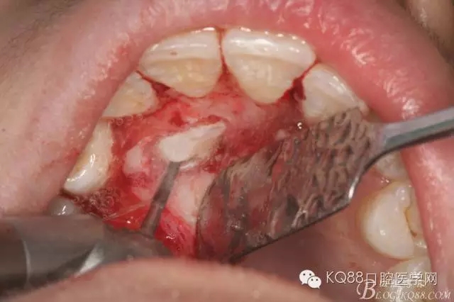 640.webp (8).jpg 640.webp (8).jpg