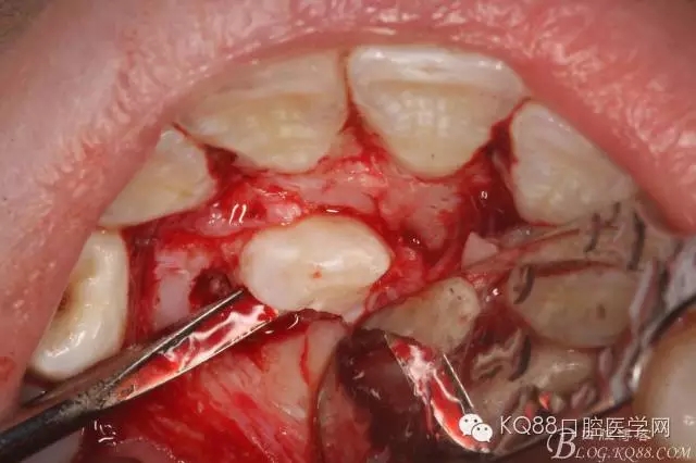 640.webp (9).jpg 640.webp (9).jpg