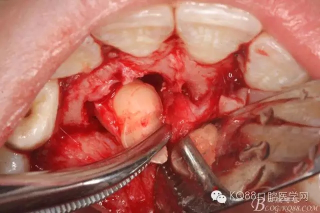 640.webp (11).jpg 640.webp (11).jpg