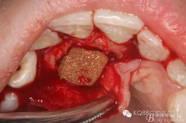 640.webp (13).jpg 640.webp (13).jpg