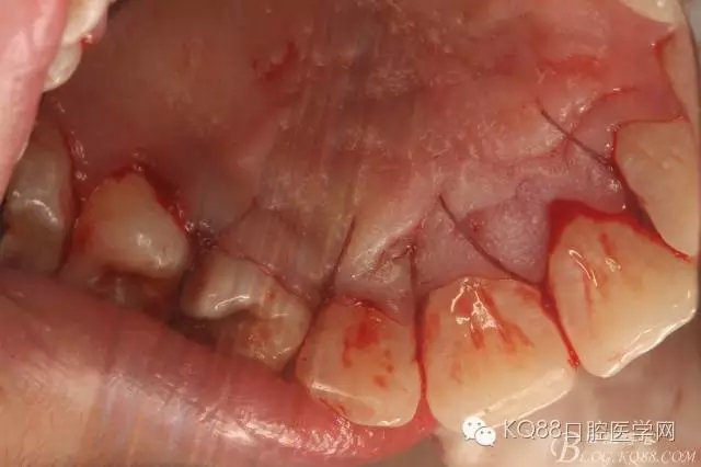 640.webp (15).jpg 640.webp (15).jpg