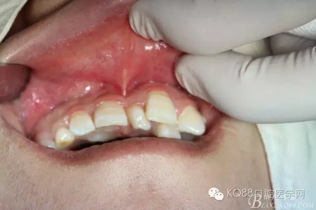 640.webp (17).jpg 640.webp (17).jpg