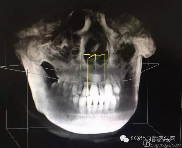 640.webp (21).jpg 640.webp (21).jpg