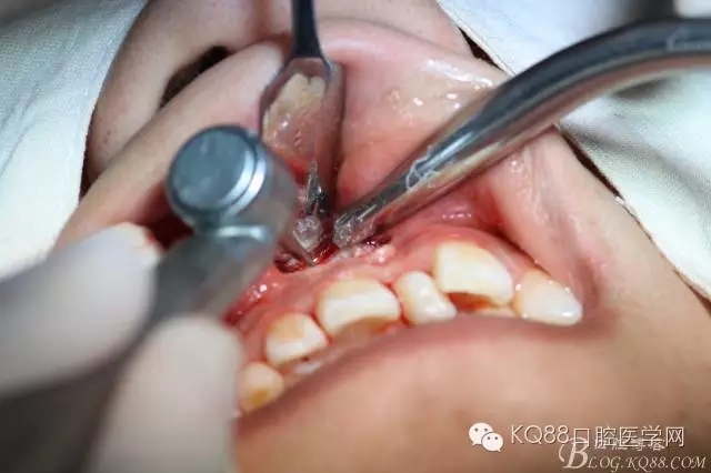 640.webp (23).jpg 640.webp (23).jpg