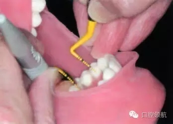 11.webp.jpg 11.webp.jpg