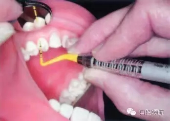 15.webp.jpg 15.webp.jpg