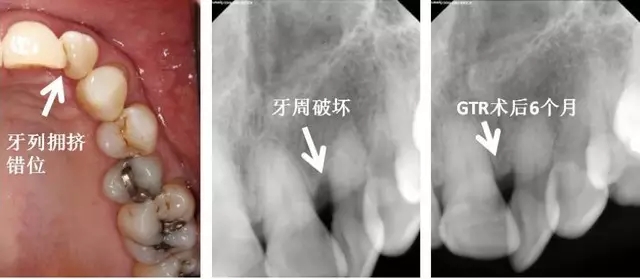 3.webp.jpg 3.webp.jpg