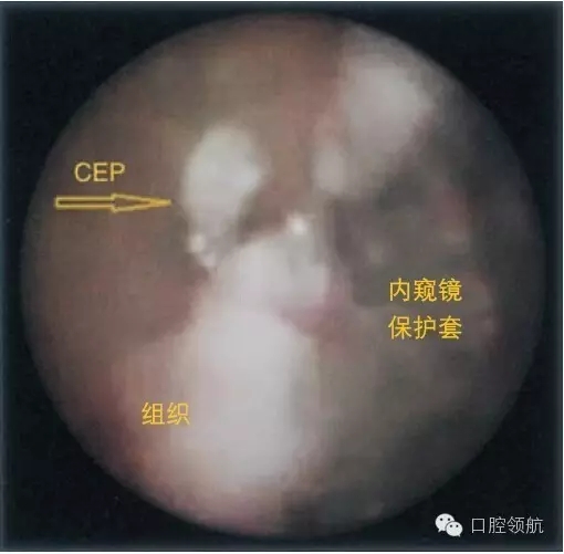 4.webp.jpg 4.webp.jpg