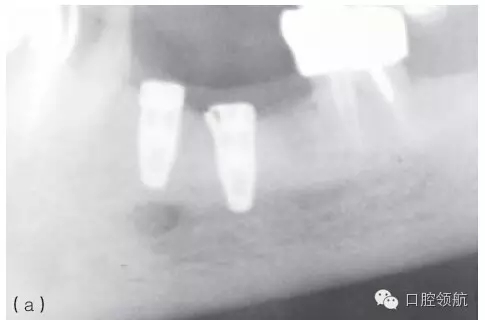 11.webp.jpg 11.webp.jpg