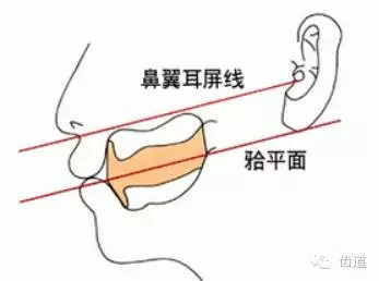 1.webp.jpg 1.webp.jpg