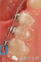 5.webp.jpg 5.webp.jpg