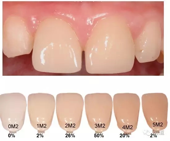 5.webp.jpg 5.webp.jpg