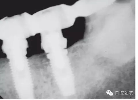 4.webp.jpg 4.webp.jpg