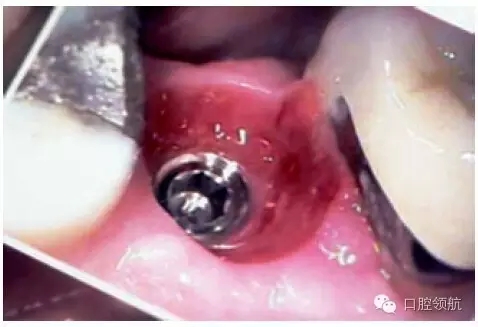 8.webp.jpg 8.webp.jpg