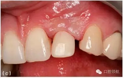 11.webp.jpg 11.webp.jpg