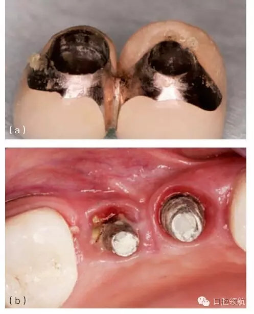 13.webp.jpg 13.webp.jpg