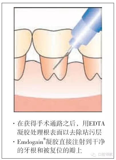 4.webp.jpg 4.webp.jpg