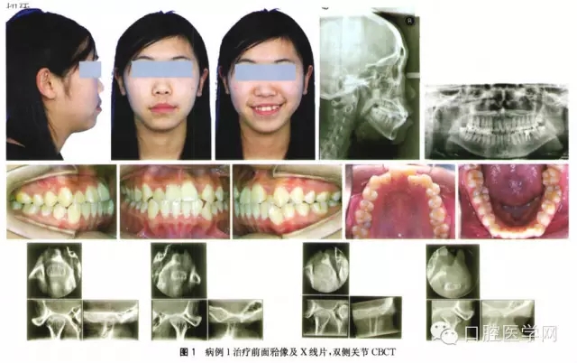 6.webp.jpg 6.webp.jpg