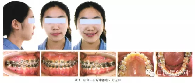 9.webp.jpg 9.webp.jpg