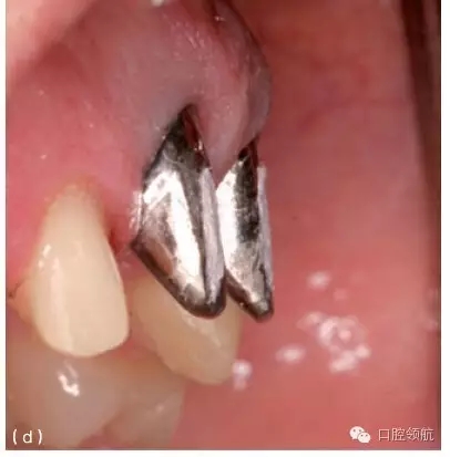 3.webp.jpg 3.webp.jpg