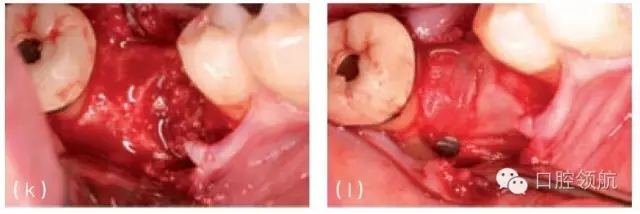 13.webp.jpg 13.webp.jpg