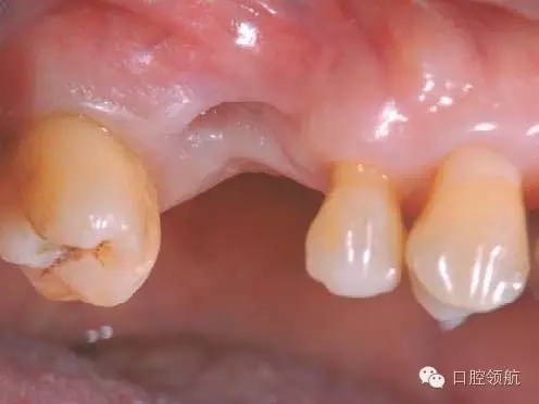 3.webp.jpg 3.webp.jpg