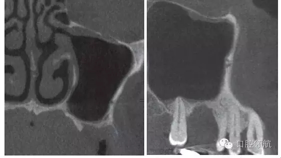 4.webp.jpg 4.webp.jpg