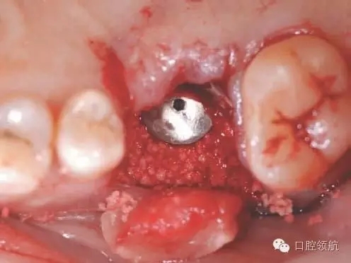 6.webp.jpg 6.webp.jpg