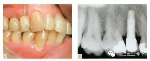 1.webp.jpg 1.webp.jpg