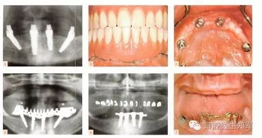 3.webp.jpg 3.webp.jpg