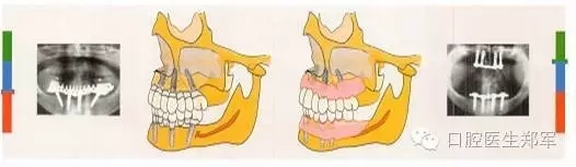 4.webp.jpg 4.webp.jpg