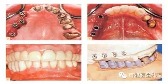 11.webp.jpg 11.webp.jpg