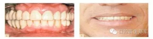 12.webp.jpg 12.webp.jpg