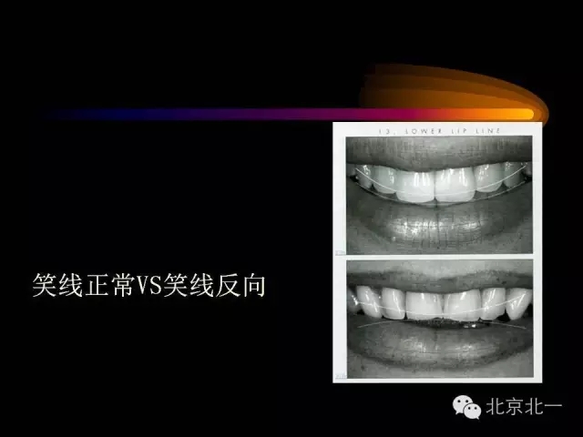 22.webp.jpg 22.webp.jpg