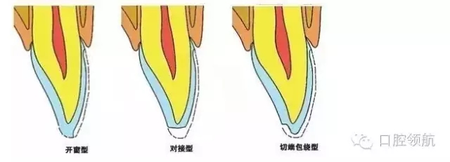 4.webp.jpg 4.webp.jpg