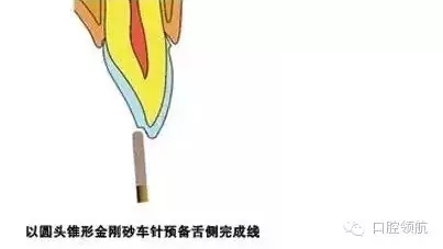 5.webp.jpg 5.webp.jpg