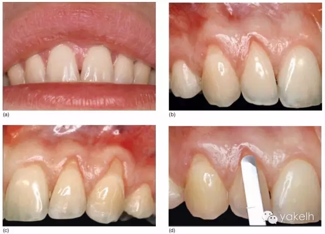 1.webp.jpg 1.webp.jpg