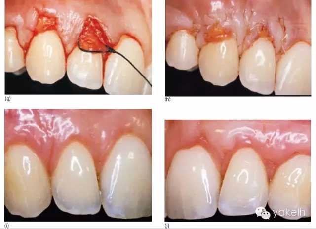 3.webp.jpg 3.webp.jpg