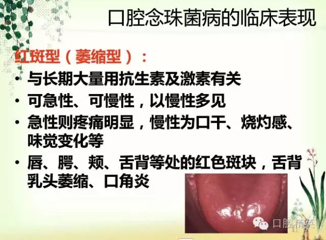 12.webp.jpg 12.webp.jpg