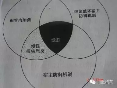 關于根管治療過程中的&ldquo;激惹&rdquo;現象
