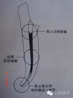 關于根管治療過程中的&ldquo;激惹&rdquo;現象