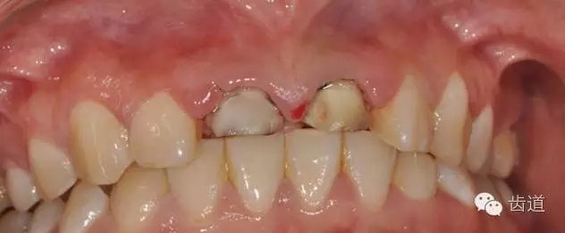 5.webp.jpg 5.webp.jpg