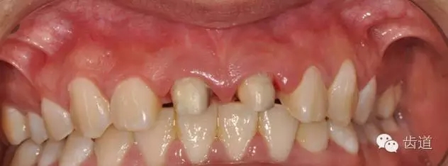 8.webp.jpg 8.webp.jpg