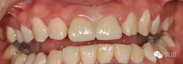 11.webp.jpg 11.webp.jpg