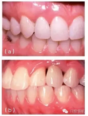 5.webp.jpg 5.webp.jpg