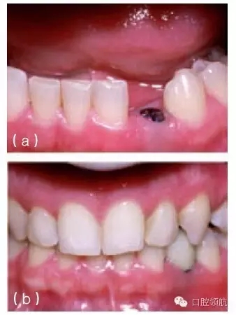 9.webp.jpg 9.webp.jpg